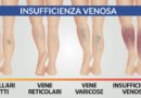 Giornata dedicata al benessere delle gambe presso la Farmacia Labriola