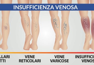 Giornata dedicata al benessere delle gambe presso la Farmacia Labriola